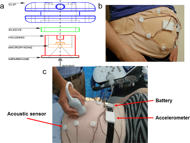 journal.pone.0195728.g001 (1).PNG